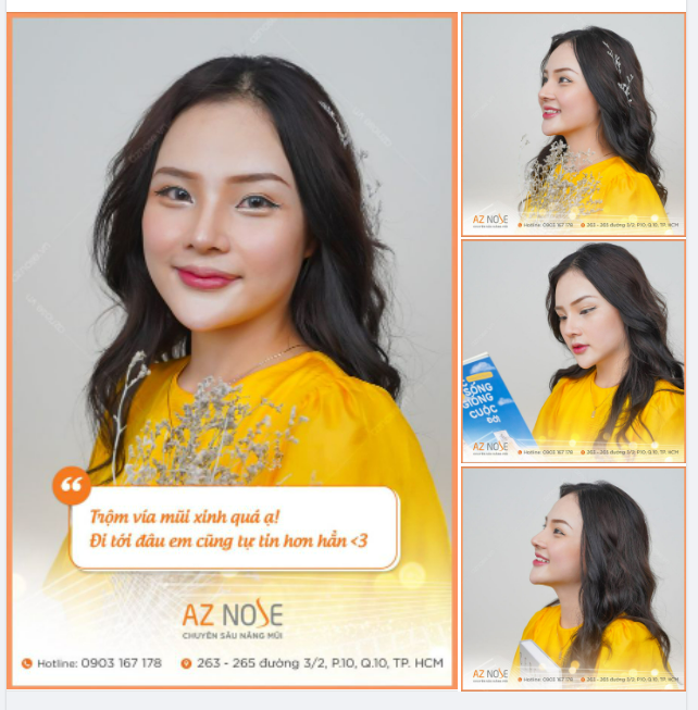 Diện mạo rạng rỡ với dáng mũi Sline cao