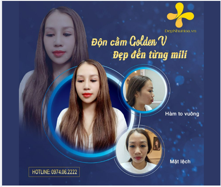 Đôi mắt được ví là cửa sổ tâm hồn còn chiếc cằm xinh, thon gọn là “hoa tiêu” của khuôn mặt