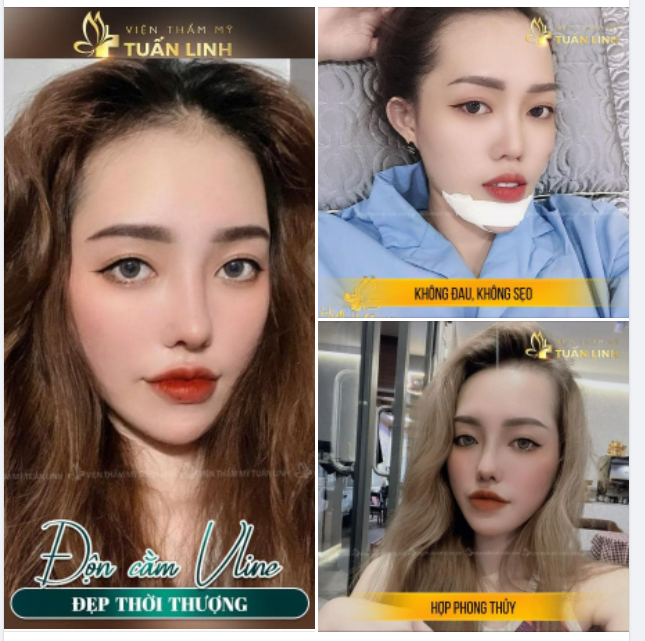 ĐỘN CẰM VLINE ĐẸP THỜI THƯỢNG - CHỈ 11 TR
