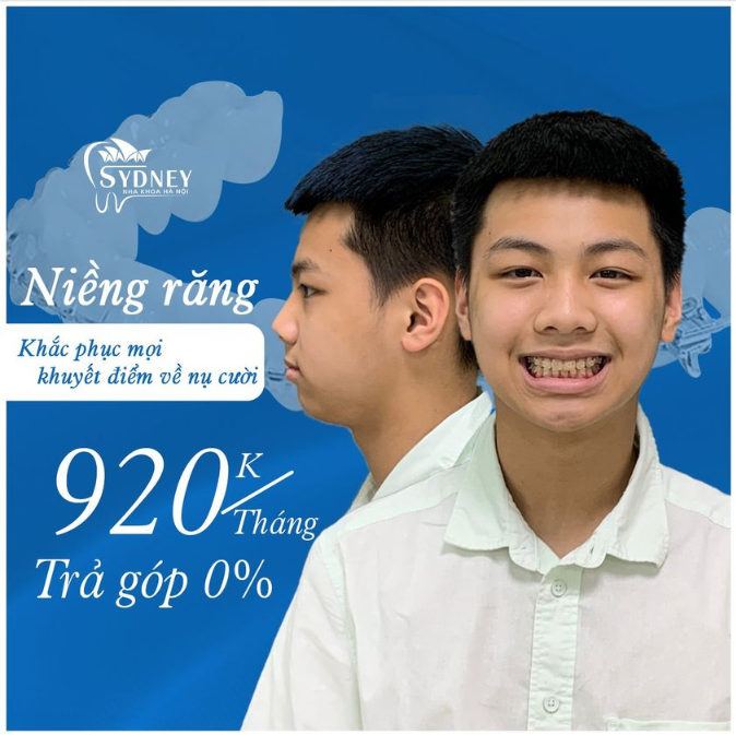 ĐỘNG LỰC NIỀNG RĂNG CỦA BẠN LÀ GÌ 