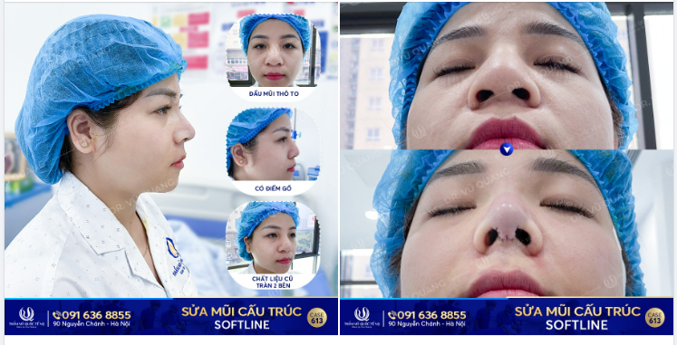 Dr Vũ Quang - Tái sinh mũi hỏng - Vực dậy niềm tin.