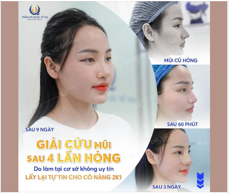 Dù bạn là ai thì mũi Softline cũng không làm bạn thất vọng