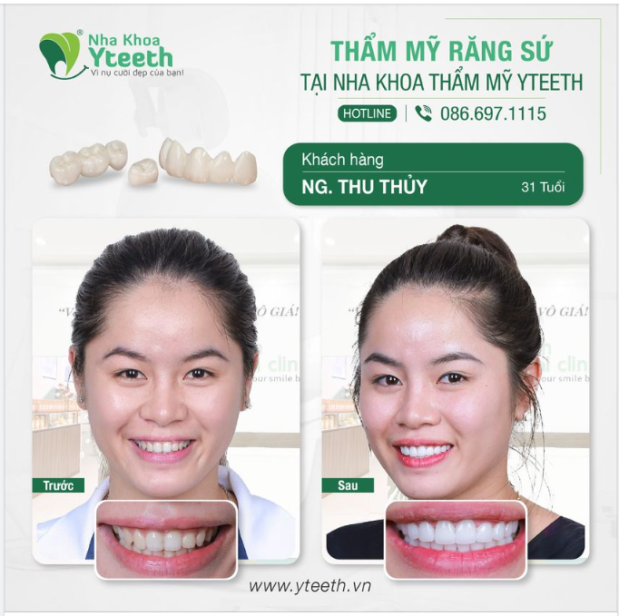 ĐỪNG CHẦN CHỪ VỚI SẮC ĐẸP VÀ SỨC KHỎE CỦA BẢN THÂN!