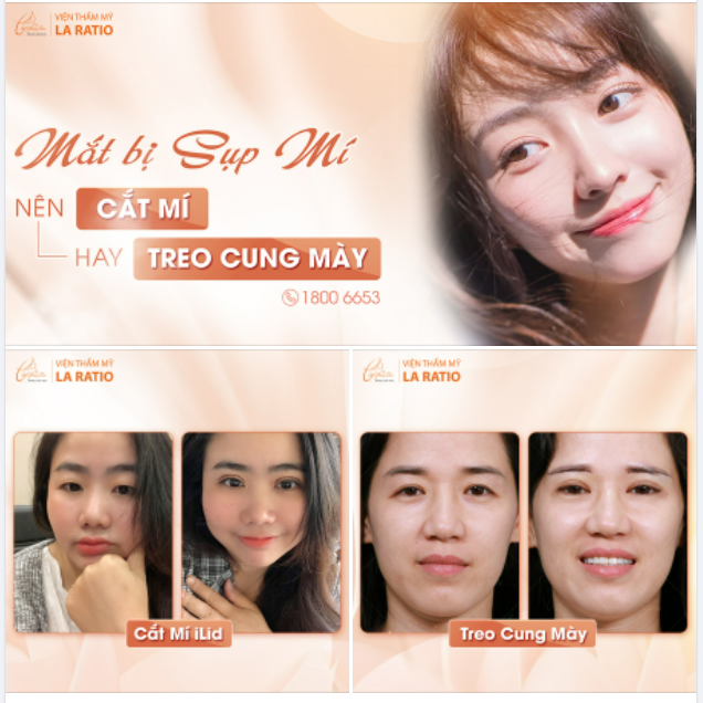 ĐỪNG ĐỂ ĐÔI MẮT SỤP MÍ TỐ CÁO TUỔI TÁC CỦA BẠN