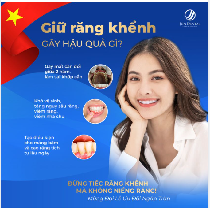 ĐỪNG TIẾC RĂNG KHỂNH MÀ KHÔNG NIỀNG RĂNG !!!