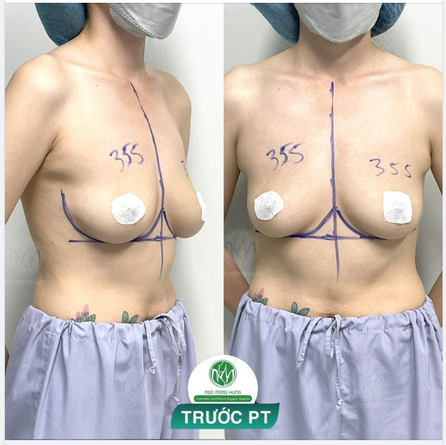 ... Em muốn có vòng 1 gợi cảm hơn