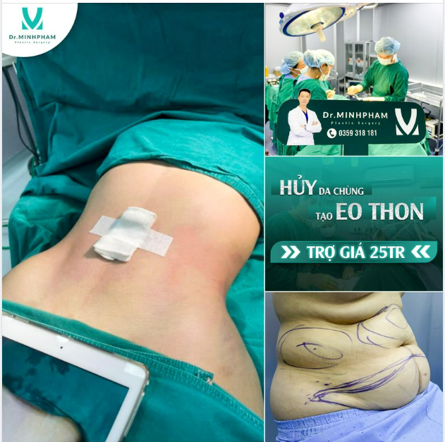 Eo phẳng lì - Mix gì cũng xinh