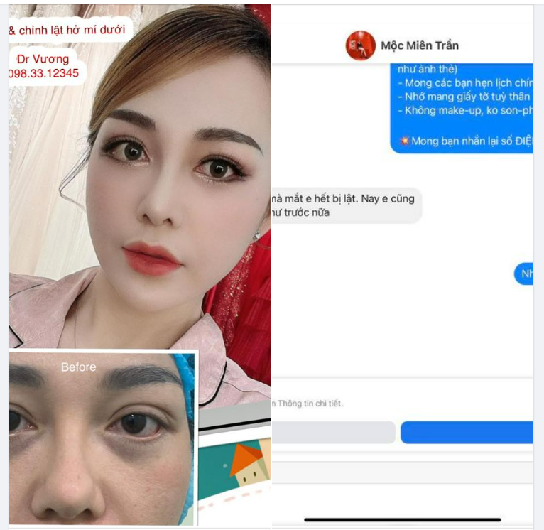 Feedback của bạn gái Vũng Tàu sau 16 ngày chỉnh sửa