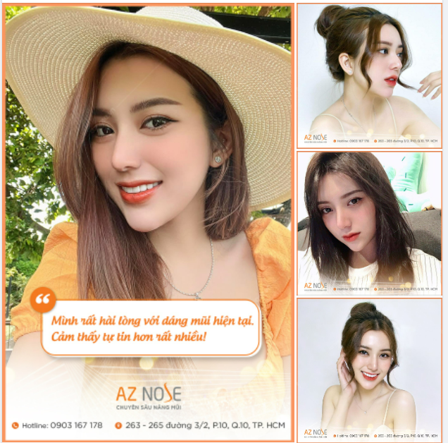 Feedback khách hàng Khuôn mặt sắc nét với dáng mũi 2 năm tuổi