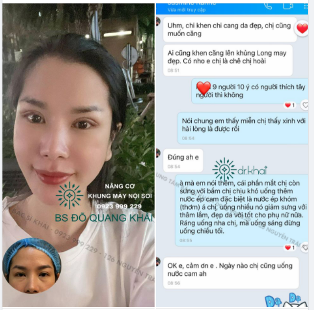 FEEDBACK NÂNG CƠ KHUNG MÀY NỘI SOI - Phương pháp trẻ hóa độc quyền Bác sĩ Khải