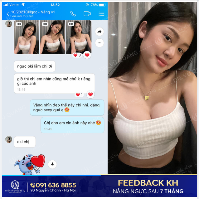 Feedback Nâng vòng 1 nội soi công nghệ cao - Độc quyền của Dr Vũ Quang sau 7 tháng thực hiện