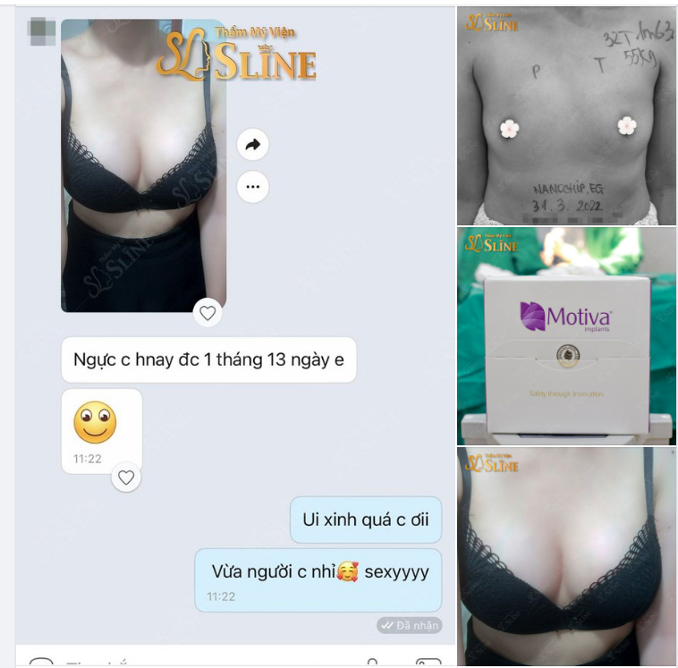 Feedback ngực hơn 1 tháng tuổi...