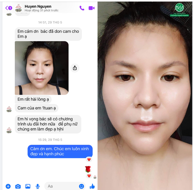 FEEDBACK SAU 1 TUẦN ĐỘ CẰM CỦA KH
