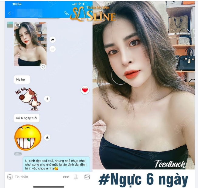 Feedback thực tế khách hàng của Sline đây ạ