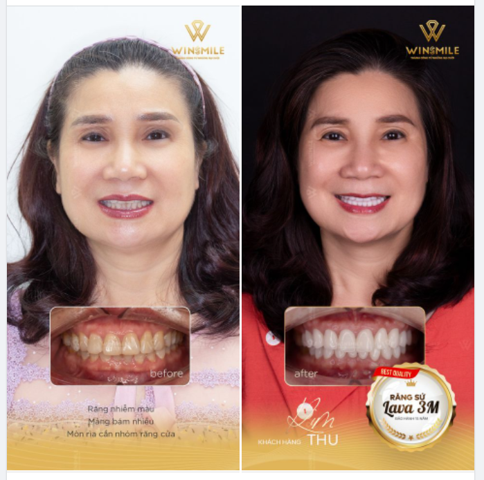 GIÁ TRỊ XỨNG TẦM CHO VẺ ĐẸP KHÔNG TUỔI