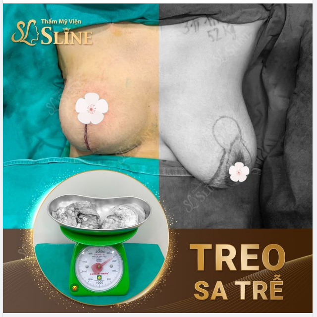 Giải cứu vòng 1 cho chị bà mẹ 2 con.
