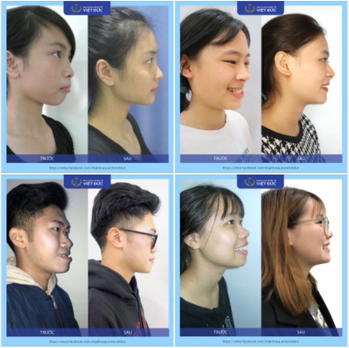 GÓC NGHIÊNG "THẦN THÁNH" MÀ CÁC ĐỒNG NIỀNG ĐỀU MƠ ƯỚC