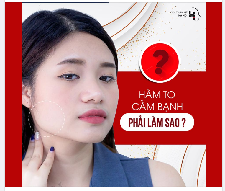 Hàm to, cằm bạnh phải làm sao