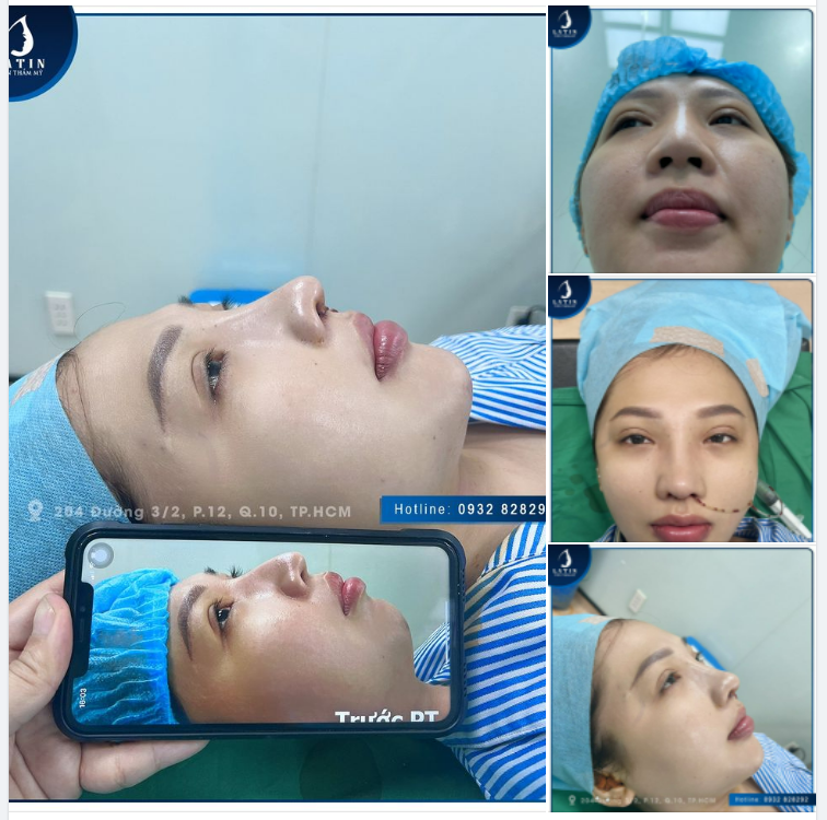 Hành trình sở hữu nhan sắc hoàn hảo cùng chị khách
