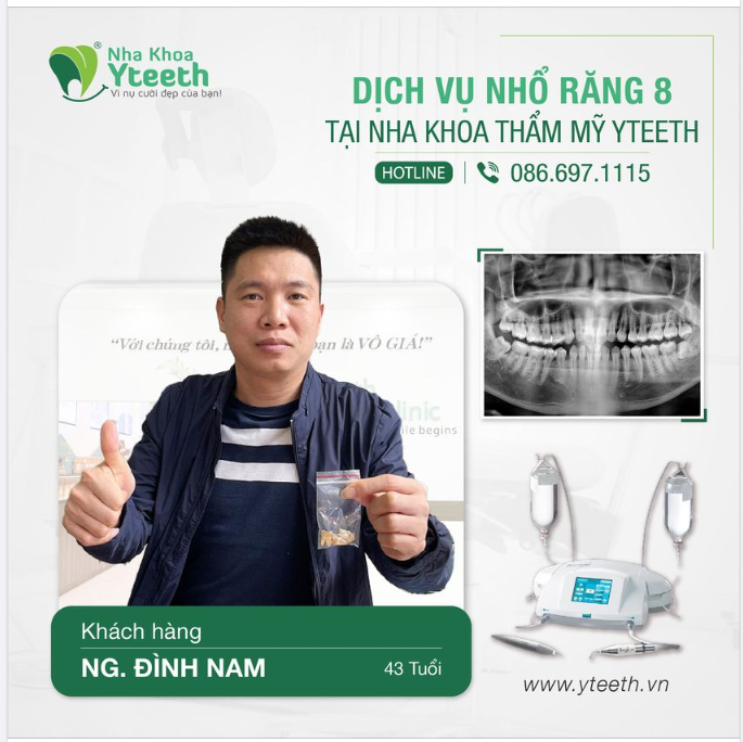 Hầu hết khách hàng sẽ chỉ tìm đến phòng khám nha khoa khi răng khôn có biểu hiện sưng, đau.