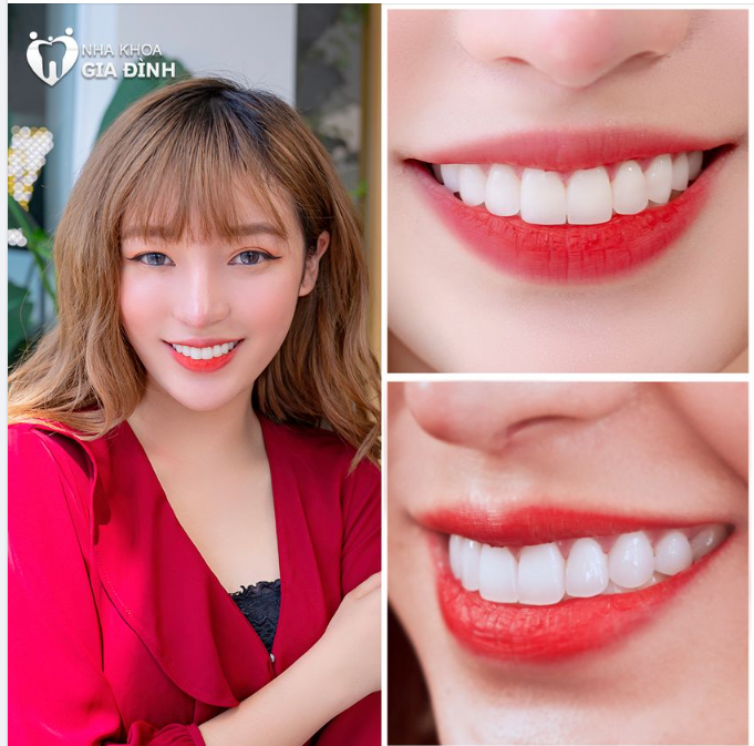 HÈ NÀY NHẤT ĐỊNH PHẢI CÓ NỤ CƯỜI ĐẸP NHƯ CÔ ẤY!!!