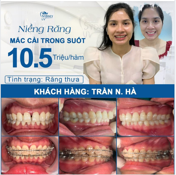 HẾT HÔ THƯA - TỰ TIN TỎA SÁNG