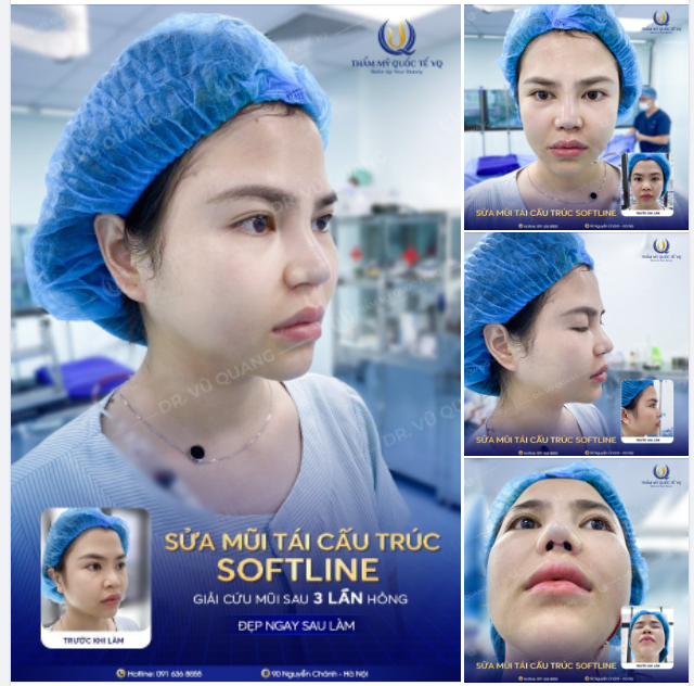 HÌNH ẢNH CHÂN THẬT NHẤT TỪ PHÒNG PHẪU THUẬT VQ