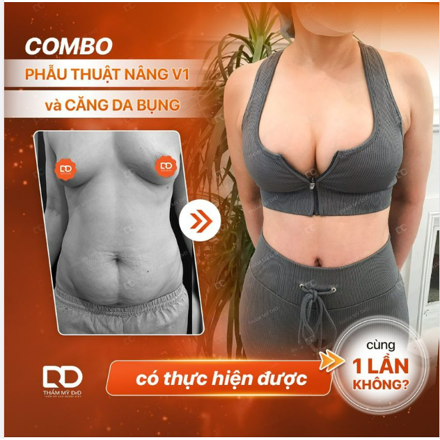 Hỏi Combo NÂNG V1 và CĂNG DA BỤNG có thực hiện được cùng 1 lần không