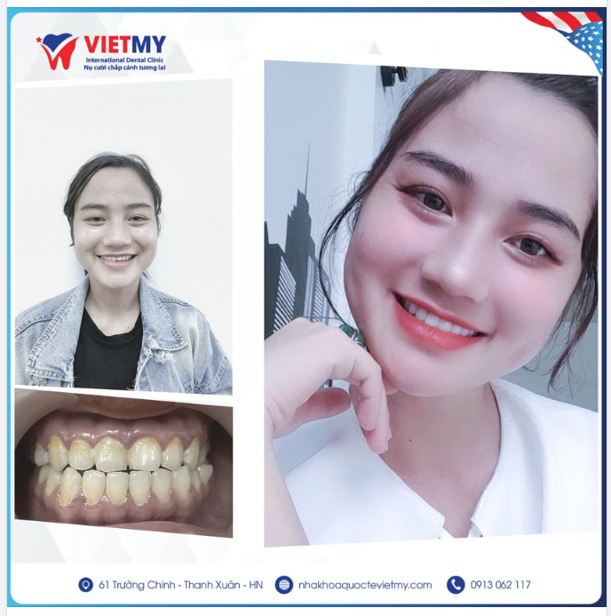 "HỒI SINH" NỤ CƯỜI, CĂNG TRÀN SỨC SỐNG