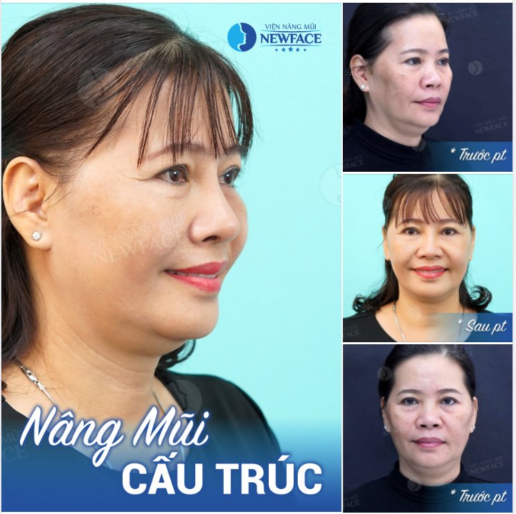 Hôm nay là ngày bạn TRẺ NHẤT trong những ngày tháng sau này. Vì vậy, ĐỪNG SỐNG HOÀI PHÍ.