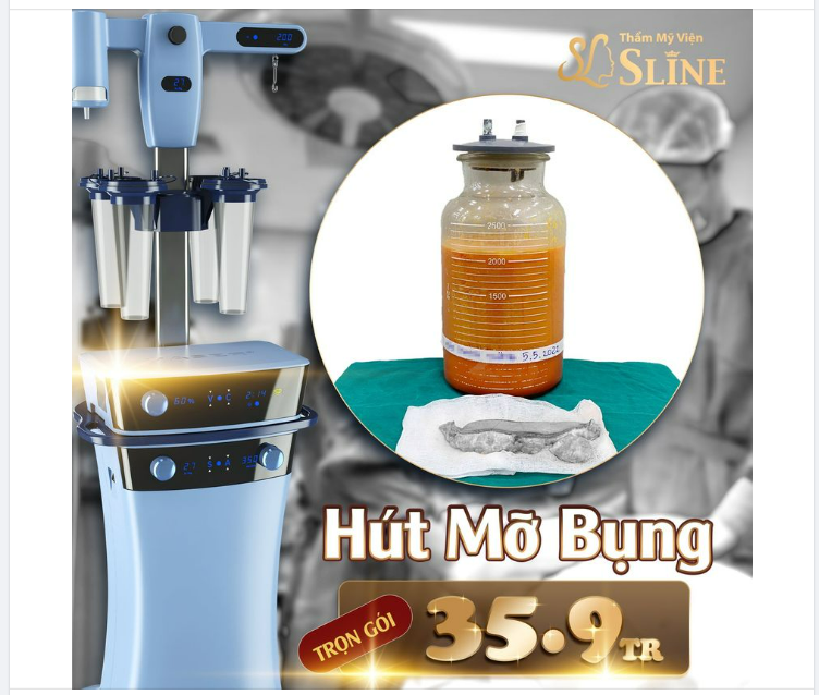 Hút mỡ bụng chỉ với 35,9 tr (TRỌN GÓI)