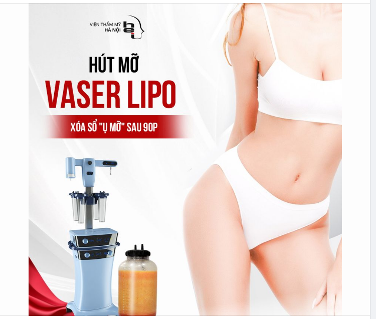 HÚT MỠ VASER LIPO - Xóa sổ ụ mỡ sau 90P
