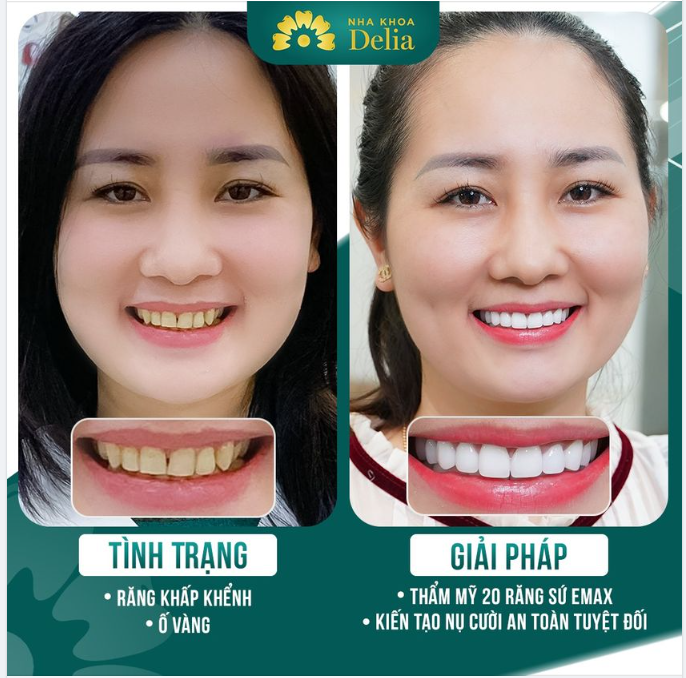 Kết quả hơn cả mong đợi