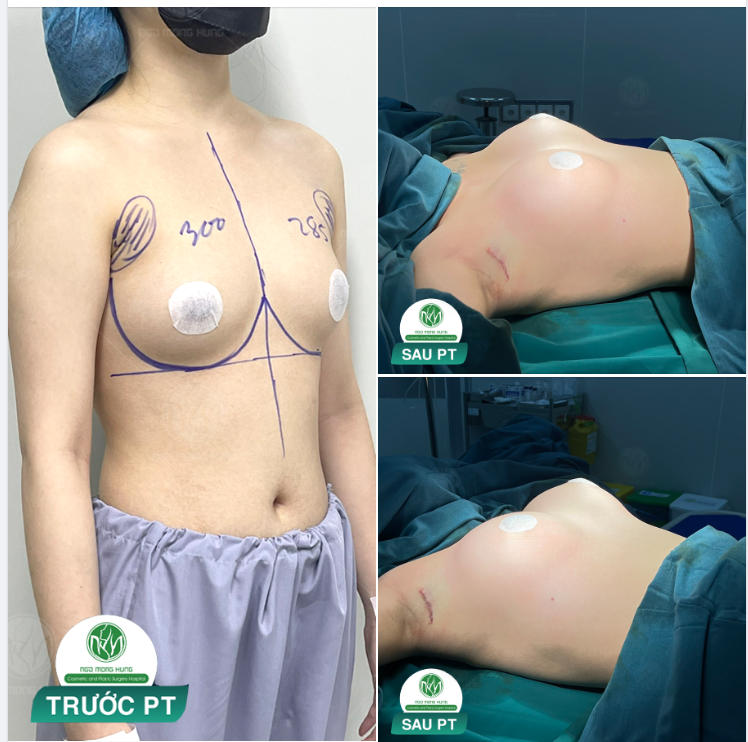 KẾT QUẢ MÀ CHỊ EM MONG CHỜ ĐÂY Ạ!!
