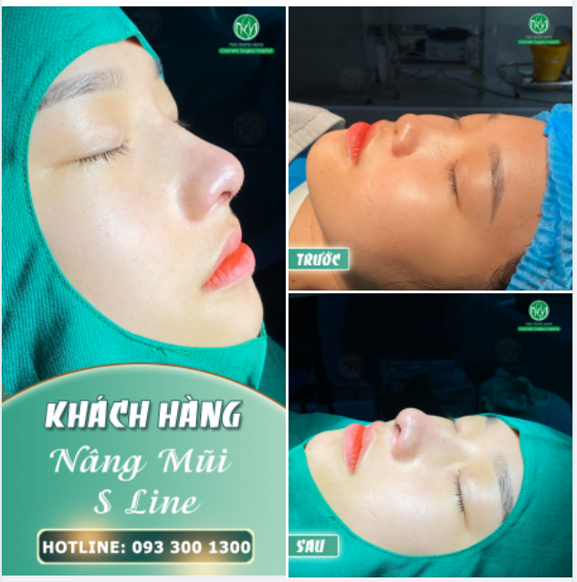KẾT THÚC NGÀY THỨ 3 VỚI KQ CA NÂNG MŨI S LINE