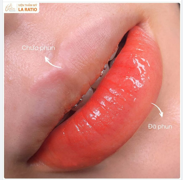 KHÁC BIỆT ĐẾN TỪ CÔNG NGHỆ PHUN MÔI ĐỘC QUYỀN LA RATIO