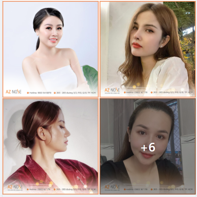 KHÁCH HÀNG 8X TRẺ TRUNG VỚI DÁNG MŨI MỚI