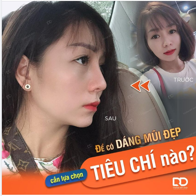 Khách hàng gửi feedback ngắn gọn cho DrD Dáng mũi đẹp và tự nhiên ạ
