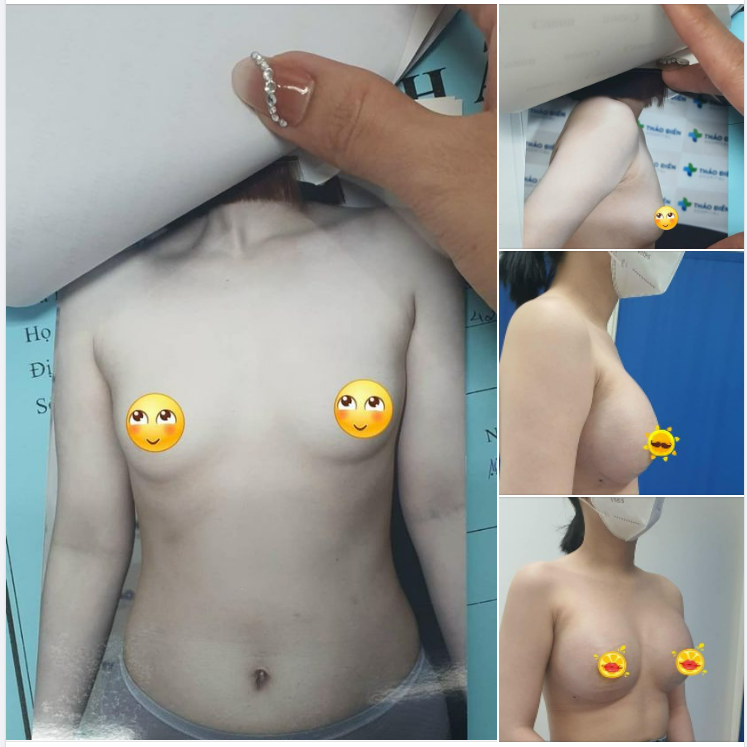 Khi cuộc sống có trăm lý do để buồn ..Thì hãy cho đời thấy bạn có ngàn lý do để đẹp
