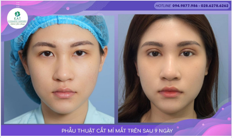 Khởi động một ngày mới với đôi mắt xinh