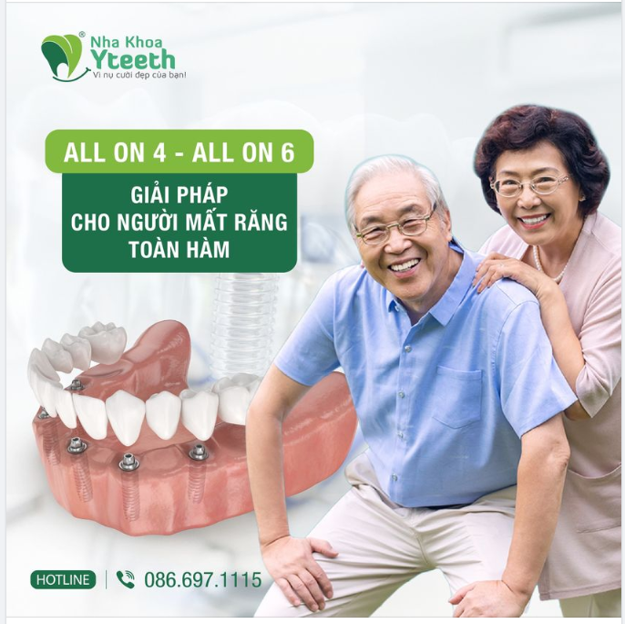 Khôi phục chức năng ăn nhai và thẩm mỹ như răng thật