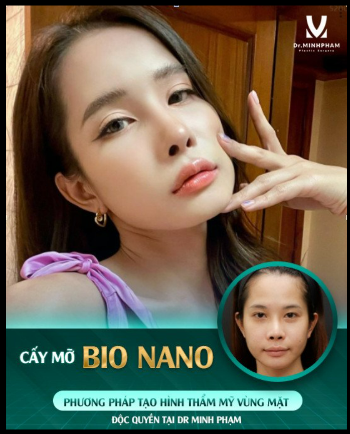 Không có phụ nữ xấu, chỉ có phụ nữ chưa đi làm đầy khuôn mặt bằng m.ỡ tự thân mà thôi...