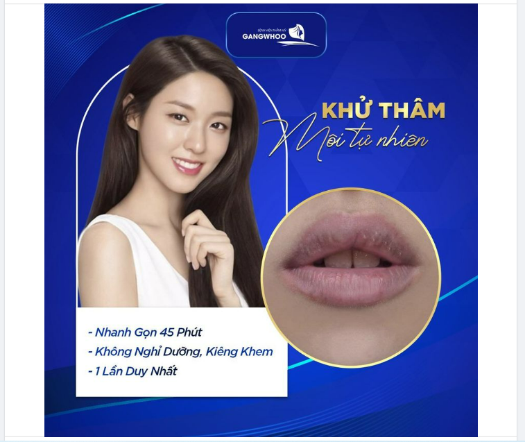 KHỬ MÔI THÂM - ĐÓN MÀU MÔI MỚI TỰ NHIÊN, SÁNG HỒNG