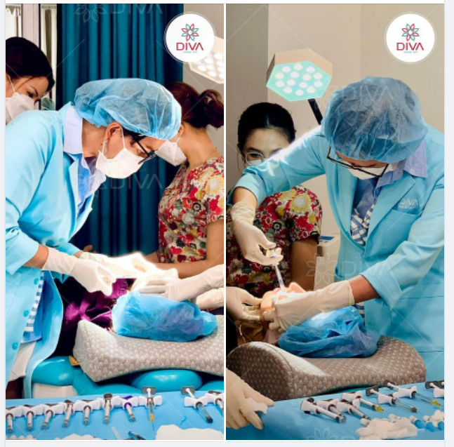 KỸ THUẬT TIÊM FILLER MD DYNAMIC CODES – KHẮC PHỤC TOÀN DIỆN MỌI VẤN ĐỀ CHẢY XỆ KHUÔN MẶT
