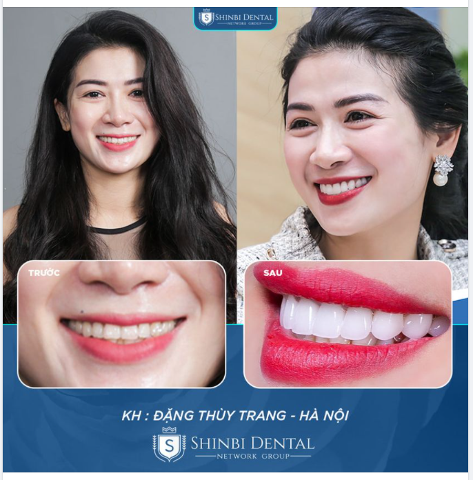 LÀ PHỤ NỮ BẠN CHỌN VAI TRÒ NÀO?