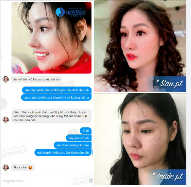 LÀM MŨI XONG LỘC LÁ HƠN, CÒN CÓ THÊM…EM BÉ!