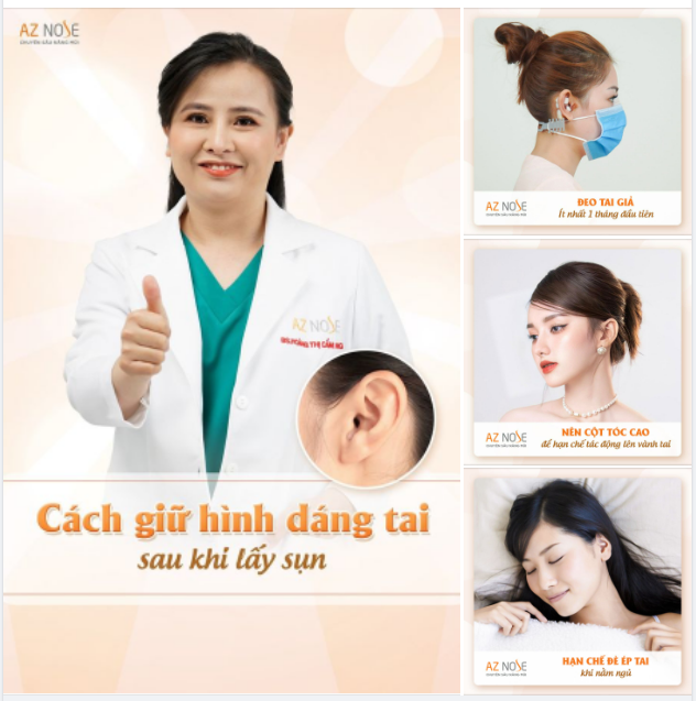 LÀM SAO ĐỂ GIỮ DÁNG TAI ĐẸP SAU KHI LẤY SỤN