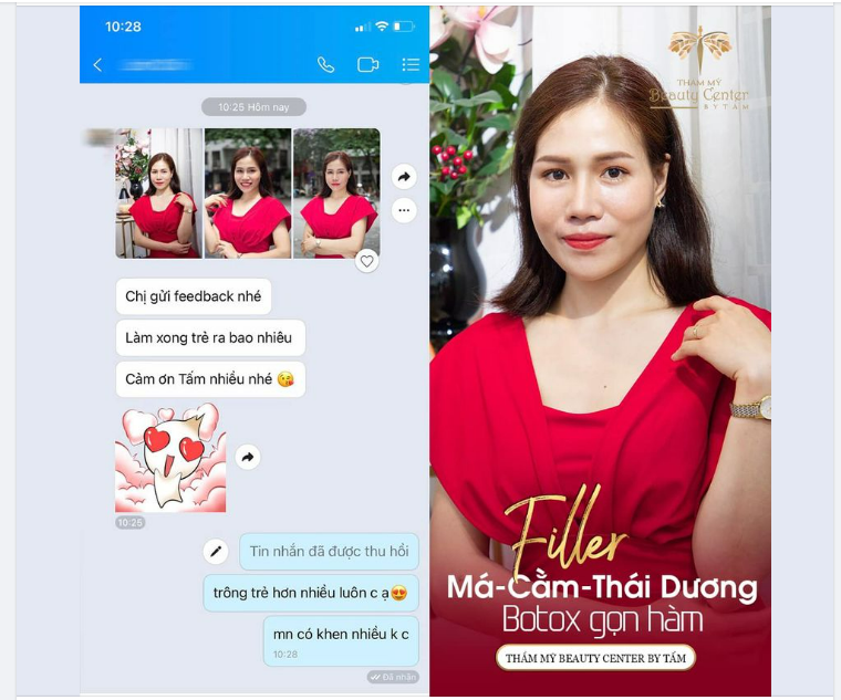 LẤY LẠI NÉT XUÂN CÙNG COMBO FILLER VÀ BOTOX GỌN HÀN TẠI TẤM