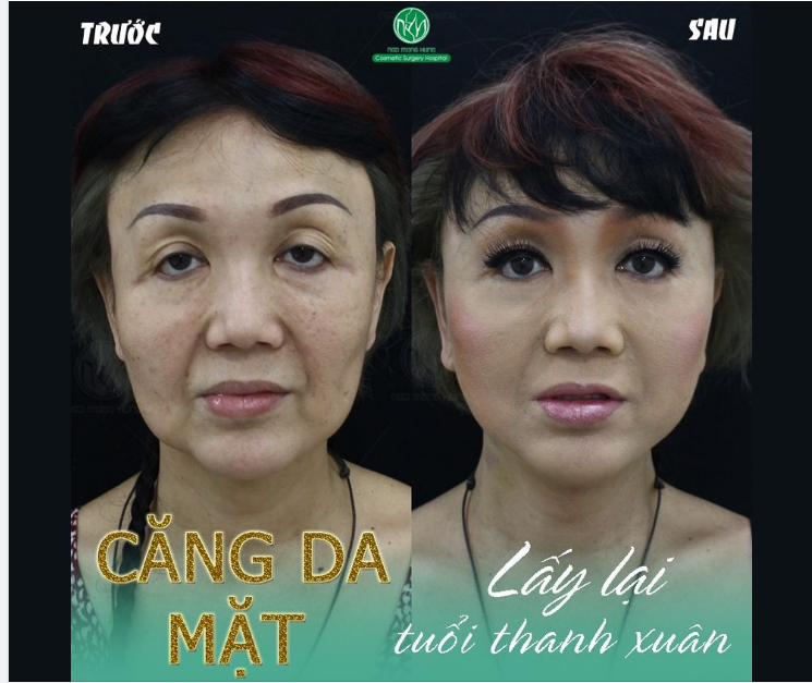 LẤY LẠI TUỔI THANH XUÂN - ĐẸP HƠN TRẺ TRUNG HƠN