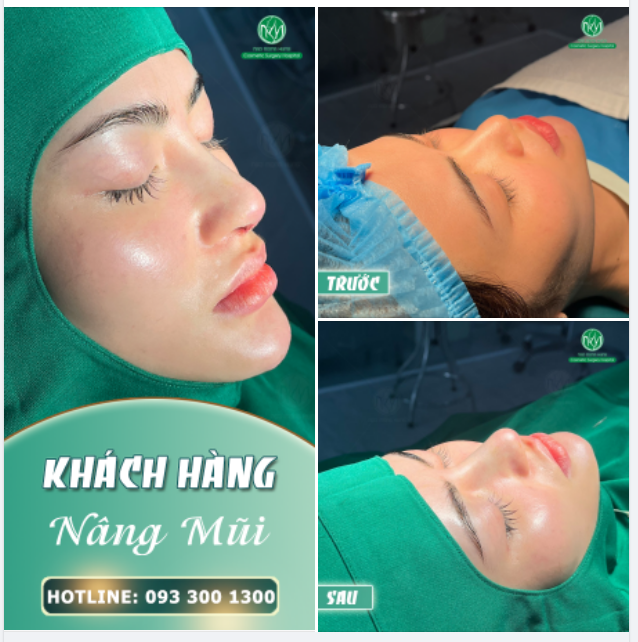 LỄ THÊM RỰC RỠ VỚI DÁNG MŨI ĐẸP XUẤT SẮC